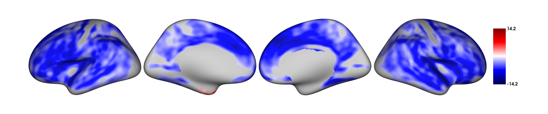 Significant clusters for the effect of age on thickness