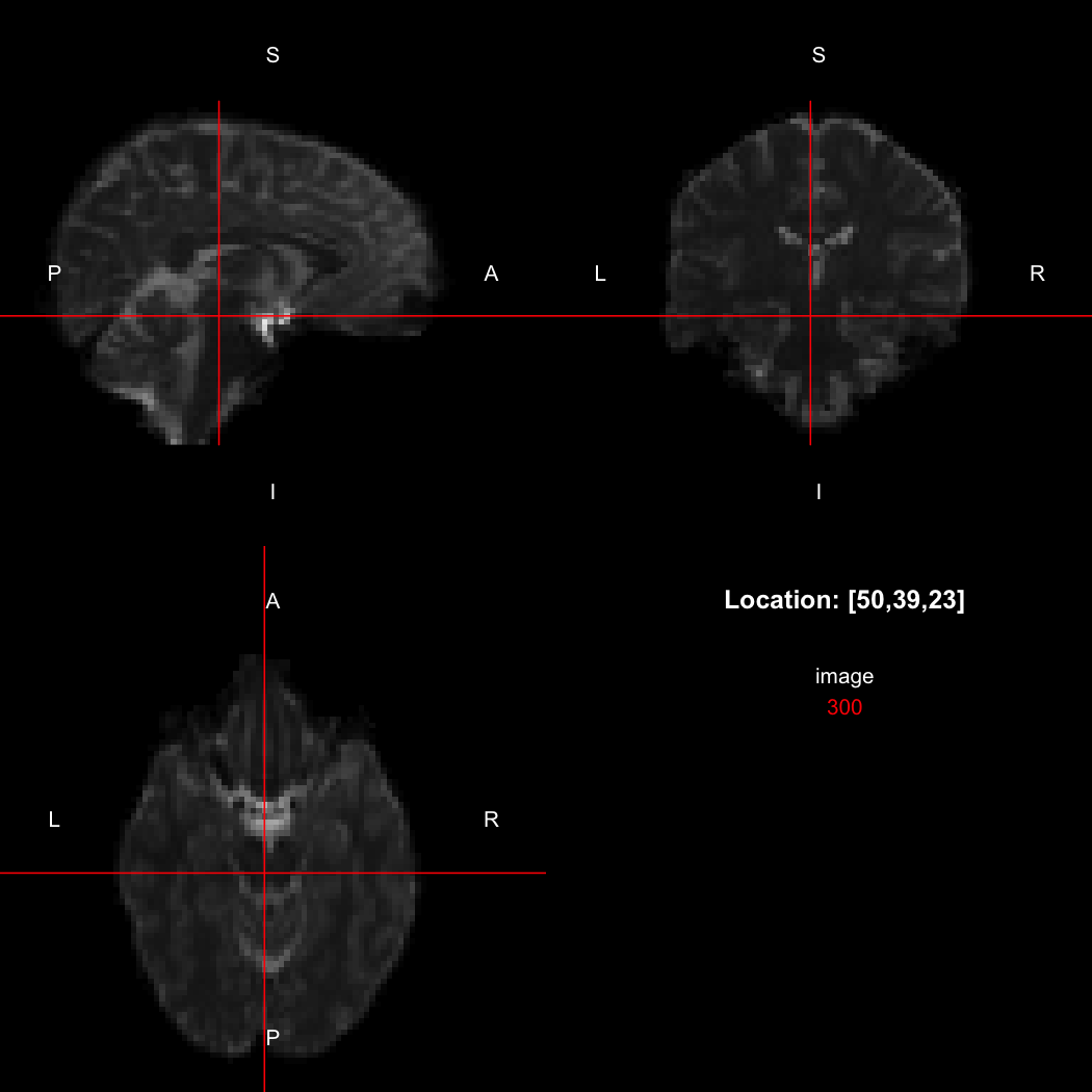 plot of chunk unnamed-chunk-5